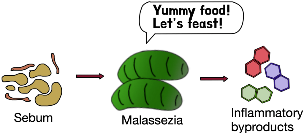 Malassezia producing inflammation on the scalp