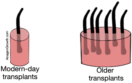 hair transplant graft size