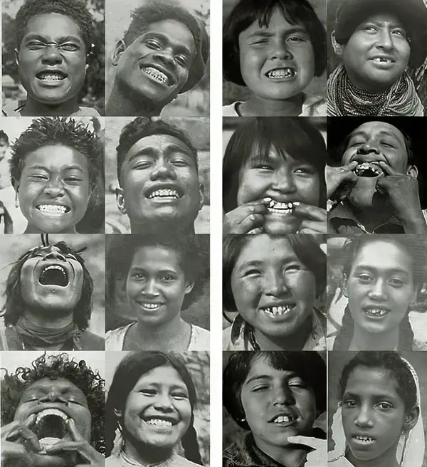 indigenous tribes teeth