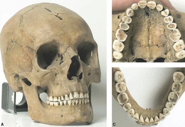 skull with straight teeth