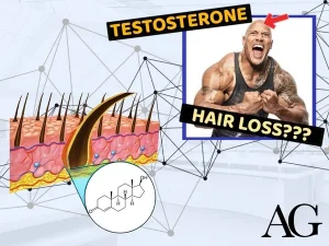 does testosterone cause hair loss article thumbnail